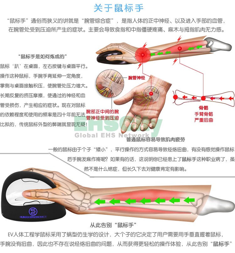 关于鼠标手